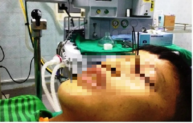 Kinh hoàng bé trai 13 tuổi bị 3 mũi tên găm vào hốc mắt - 1