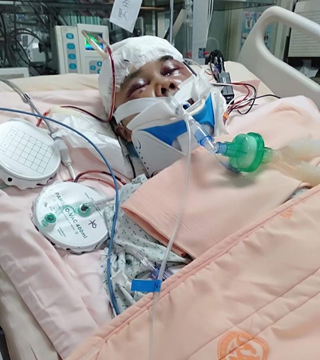 Lật xe ở Đài Loan, 2 lao động Việt Nam thương vong - 1