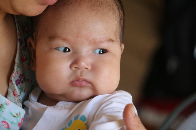 Ánh mắt cầu cứu của bé gái 5 tháng tuổi bị ung thư máu - 7