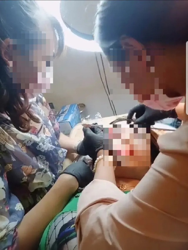 Thêm một phụ nữ ngưng tim, ngưng thở khi đi làm đẹp - 1 Thêm một phụ nữ ngưng tim, ngưng thở khi đi làm đẹp - 1