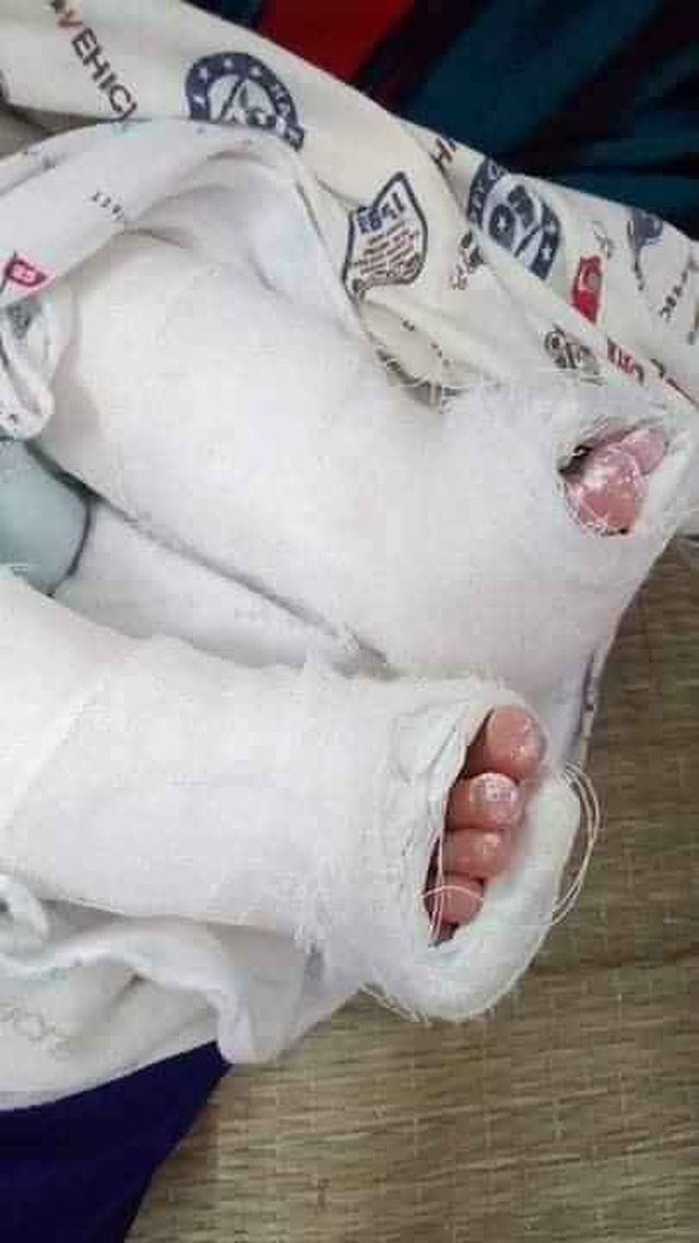 Tiếng khóc xé lòng của bé 8 tháng tuổi bị bệnh tật bủa vây - 2 Tiếng khóc xé lòng của bé 8 tháng tuổi bị bệnh tật bủa vây - 2