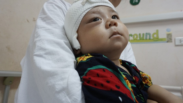 Xót thương bé trai dân tộc Nùng 7 tháng tuổi bị khối u đẩy lồi mắt ra ngoài - Ảnh 5.