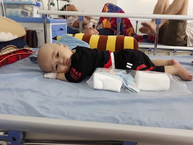 Cầu mong phép mầu đến với bé trai 1 tuổi bị ung thư kép hành hạ - 2