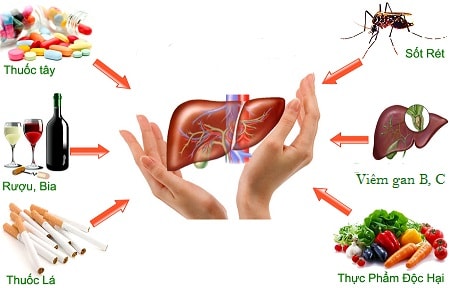 Nếu thấy dấu hiệu này, có thể con bạn đã mắc suy gan cấp - Ảnh 2.