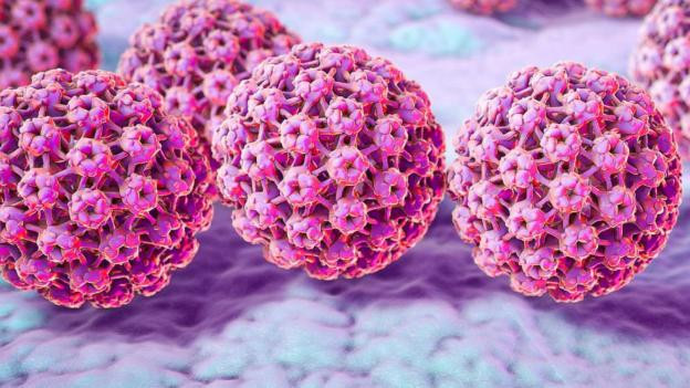 Chuyên gia cảnh báo ung thư do HPV gây ra ở nam giới sẽ cao hơn ở phụ nữ - Ảnh 1.