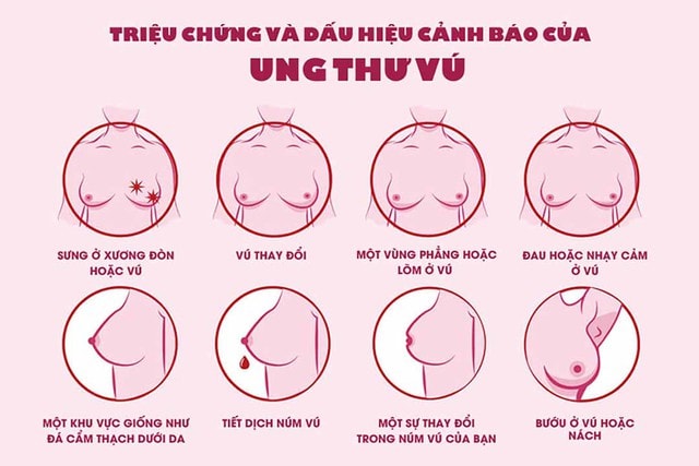 Bệnh viện Chợ Rẫy khám tầm soát ung thư vú miễn phí - Ảnh 1.