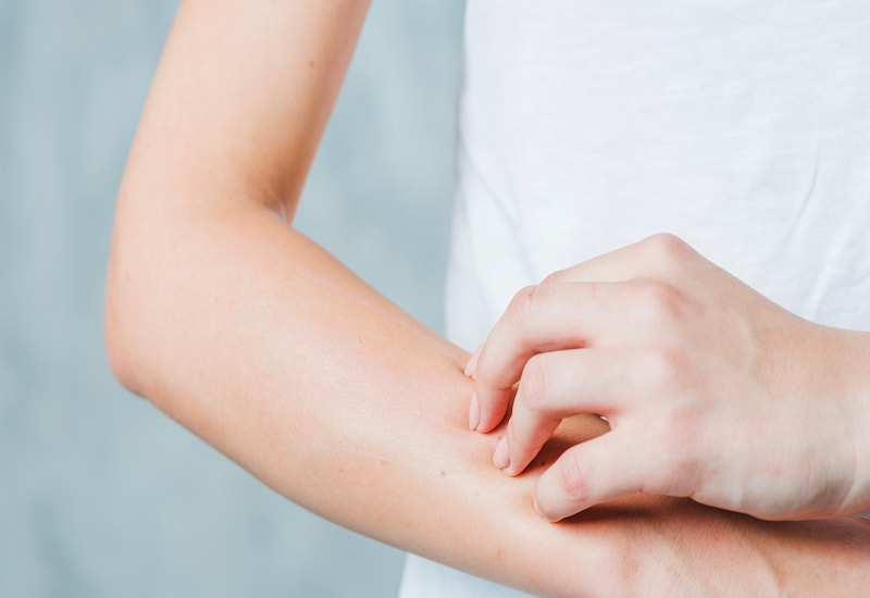 10 biến chứng tiểu đường ở da  - Ảnh 2.