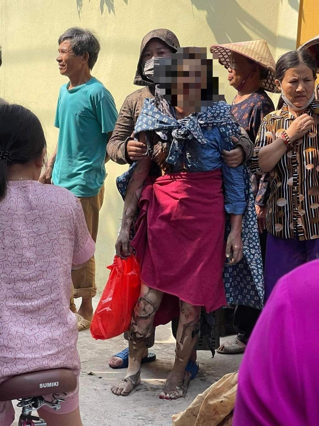 Vụ 3 con gái mang xăng đốt nhà mẹ đẻ ở Hưng Yên: Người mẹ vừa được phẫu thuật - Ảnh 2.