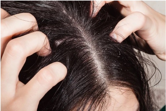 Trời lạnh, lưu ý 6 thời điểm trong ngày không nên gội đầu vì rất dễ ốm sốt - Ảnh 2. Trời lạnh, lưu ý 6 thời điểm trong ngày không nên gội đầu vì rất dễ ốm sốt - Ảnh 2.