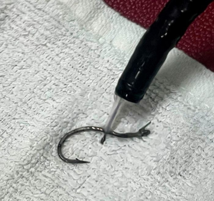 Gắp lưỡi câu mắc trong thực quản bệnh nhân - Ảnh 2.