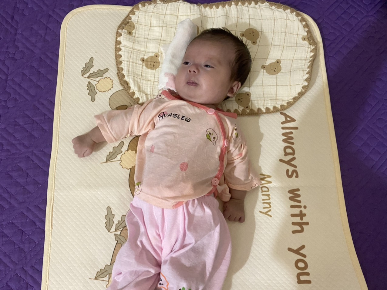 MS 871: Xót xa hình ảnh bé gái 2 tháng tuổi bị tim bẩm sinh cần sự trợ giúp để sớm phẫu thuật - Ảnh 2.
