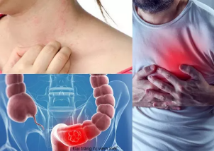 Mất cân bằng vi khuẩn ruột và những hệ lụy nguy hiểm- Ảnh 2.