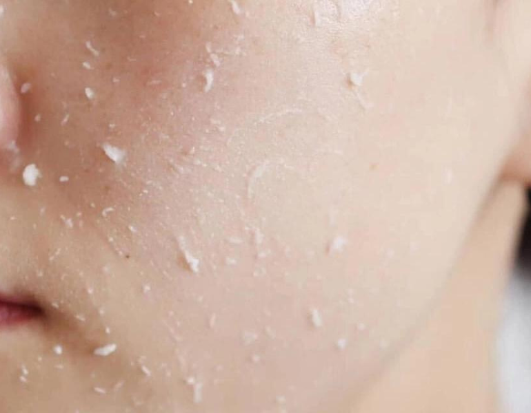 Cách lựa chọn sản phẩm và tẩy da chết cho da dầu- Ảnh 1.