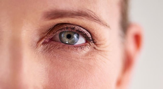 5 loại mặt nạ tự nhiên giảm nếp nhăn quanh mắt- Ảnh 1.