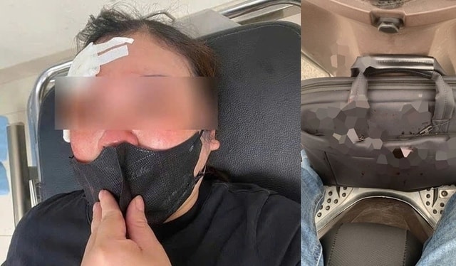 Một phụ nữ bị đánh giữa phố vì dừng xe nghe điện thoại- Ảnh 2.