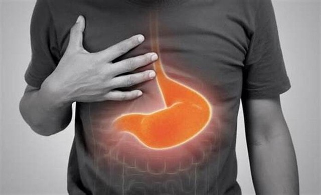Cách ăn sữa chua tốt cho người bị trào ngược dạ dày thực quản- Ảnh 1.