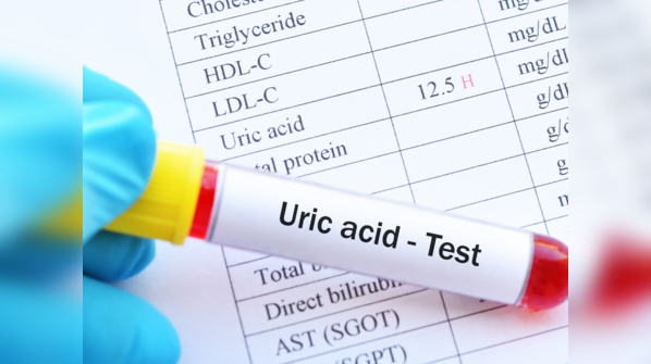 6 loại thực phẩm cần tránh nếu axit uric của bạn cao