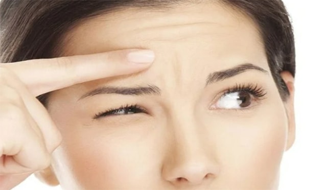 Nếp nhăn trán khi còn trẻ, làm sao để mờ dần?- Ảnh 1.