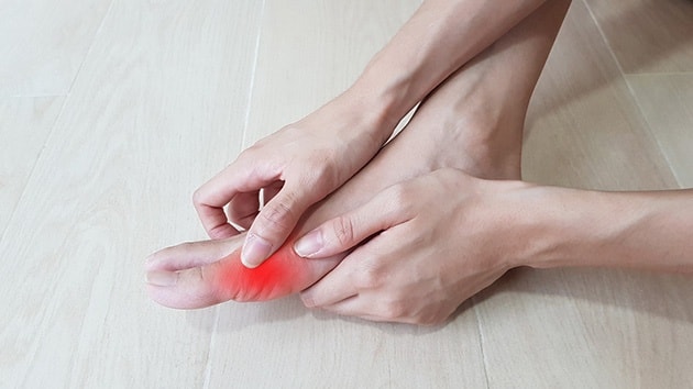 nhung-dieu-can-lam-khi-trieu-chung-gout-tai-phat11652239700