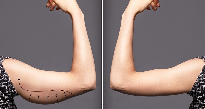 Chế độ ăn giúp bắp tay thon gọn cho phụ nữ trung niên- Ảnh 1.