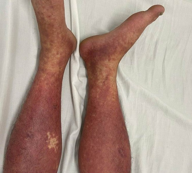 Bộ Y tế cảnh báo: Tuyệt đối không mua, bán, sử dụng thuốc chứa hoạt chất cấm Phenylbutazone - Ảnh 2.