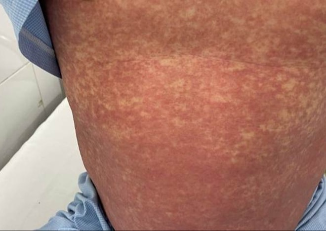 Bộ Y tế cảnh báo: Tuyệt đối không mua, bán, sử dụng thuốc chứa hoạt chất cấm Phenylbutazone - Ảnh 1.