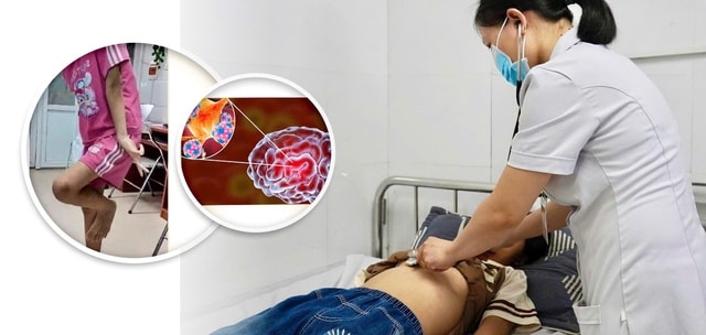 Cứu sống bé gái 12 tuổi bị viêm não tự miễn- Ảnh 1.