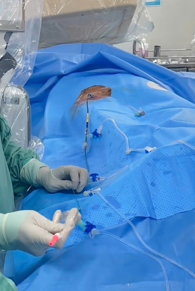 Đột quỵ do xơ vữa động mạch, làm gì để phòng tránh?- Ảnh 6.