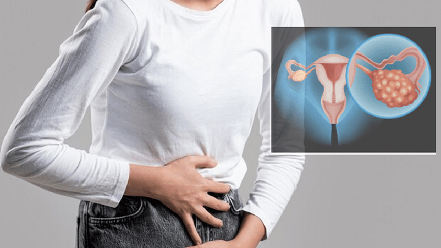 Có thể phát hiện sớm ung thư buồng trứng không?- Ảnh 1.