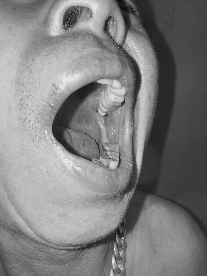 Uống sai liều thuốc da liễu, nhiều người ngộ độc nặng- Ảnh 1.