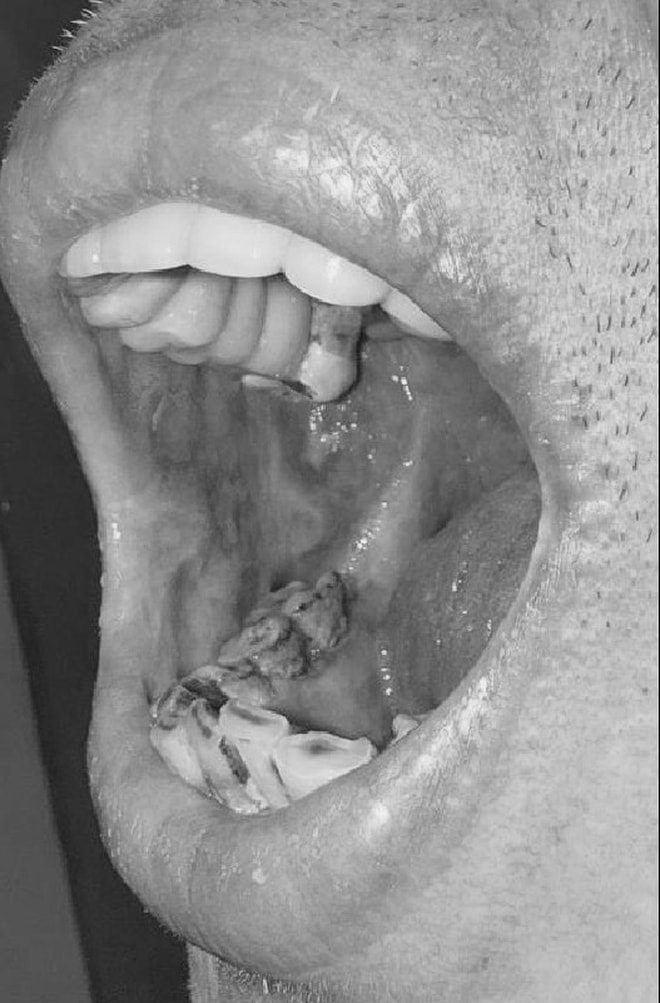 Uống sai liều thuốc da liễu, nhiều người ngộ độc nặng- Ảnh 2.