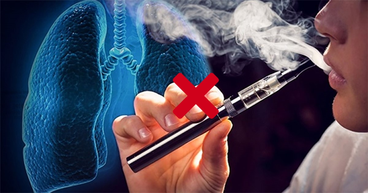 Bác sĩ nhắn nhủ giới trẻ không để bị mê hoặc bởi thuốc lá điện tử- Ảnh 1. Bác sĩ nhắn nhủ giới trẻ không để bị mê hoặc bởi thuốc lá điện tử- Ảnh 1.