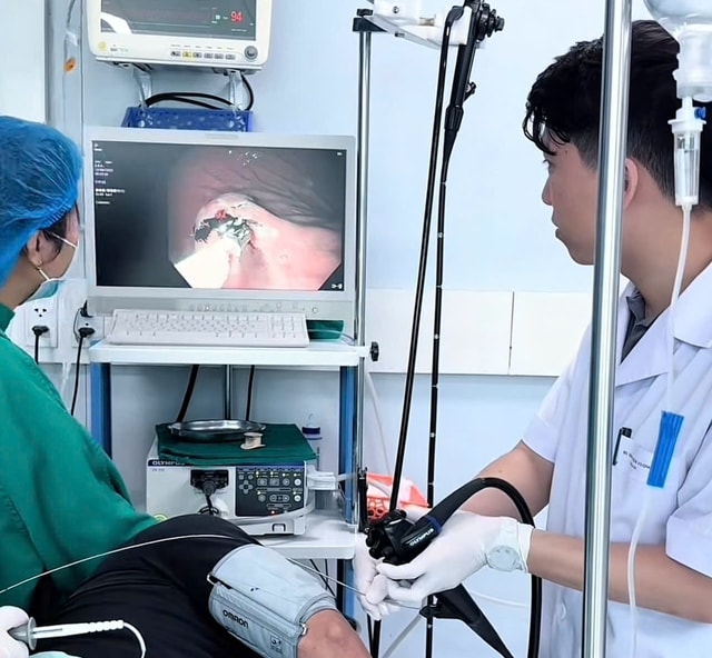 Đi khám vì ho, người đàn ông phát hiện u mô đệm dạ dày nguy hiểm- Ảnh 1.