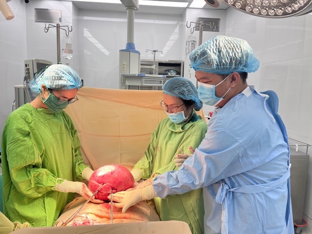 Cắt khối u xơ tử cung nặng 4,5kg, bụng nữ bệnh nhân to như thai 28 tuần- Ảnh 4. Cắt khối u xơ tử cung nặng 4,5kg, bụng nữ bệnh nhân to như thai 28 tuần- Ảnh 4.