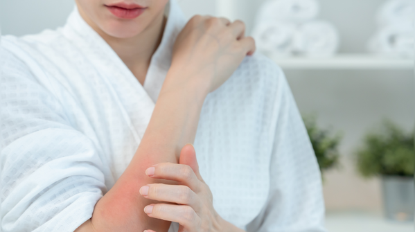 6 dấu hiệu trên da cảnh báo gan cần được chăm sóc ngay- Ảnh 1. 6 dấu hiệu trên da cảnh báo gan cần được chăm sóc ngay- Ảnh 1.