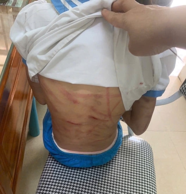 Bắt giữ bố dượng nghi bạo hành bé gái lớp 5 ở Hà Tĩnh- Ảnh 2. Bắt giữ bố dượng nghi bạo hành bé gái lớp 5 ở Hà Tĩnh- Ảnh 2.