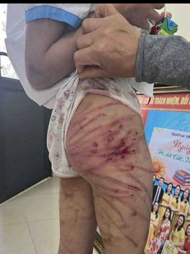 Hành vi bạo hành trẻ em sẽ bị xử lý như thế nào? - Ảnh 1. Hành vi bạo hành trẻ em sẽ bị xử lý như thế nào? - Ảnh 1.