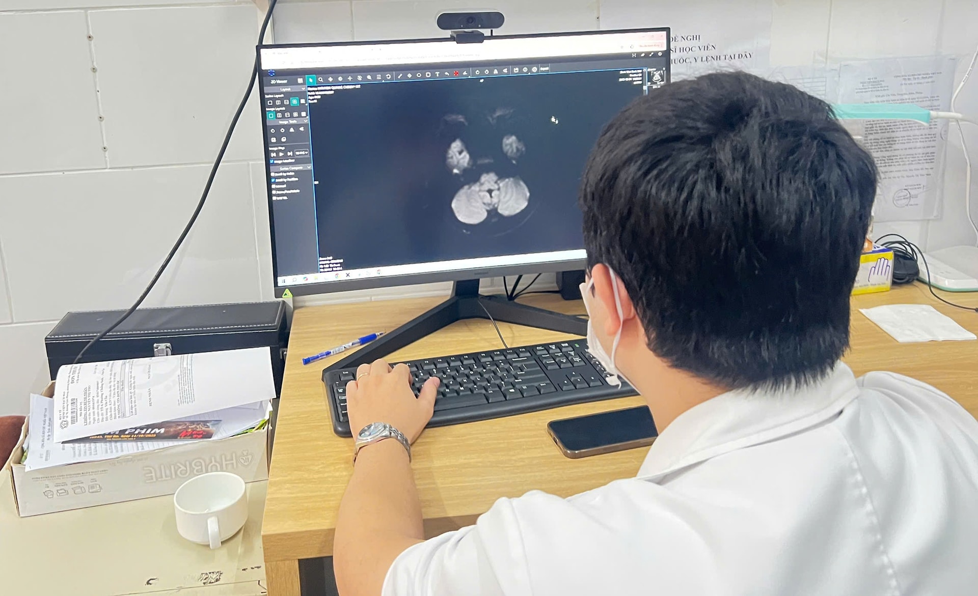 Cảnh báo từ phòng cấp cứu: Thiếu niên 15 tuổi tổn thương não vì ngộ độc thuốc lá điện tử chứa ma túy- Ảnh 1.