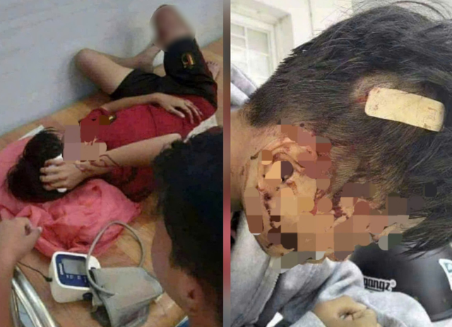 Vết thương dai dẳng từ bạo lực học đường và bài toán an toàn chưa lời giải- Ảnh 1. Vết thương dai dẳng từ bạo lực học đường và bài toán an toàn chưa lời giải- Ảnh 1.