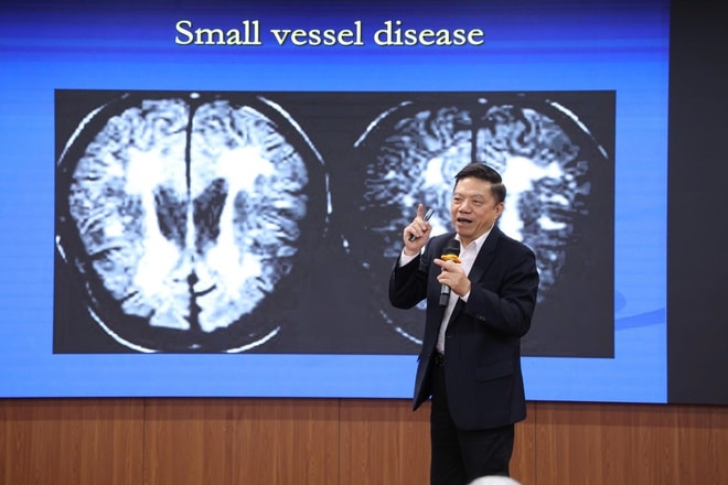 Người trẻ đối mặt với gánh nặng kép của đột quỵ não và sa sút trí tuệ- Ảnh 5.