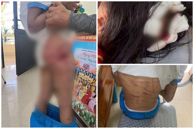 Bạo hành trẻ em: Vết thương từ gia đình và rào cản pháp lý- Ảnh 1.