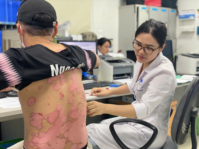 Tự chữa vảy nến, bệnh nhân phải nằm cáng nhập viện- Ảnh 3. Tự chữa vảy nến, bệnh nhân phải nằm cáng nhập viện- Ảnh 3.
