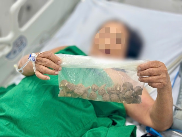 Đặt mua củ ấu tẩu trên mạng để chữa khớp, người phụ nữ suýt tử vong- Ảnh 2.