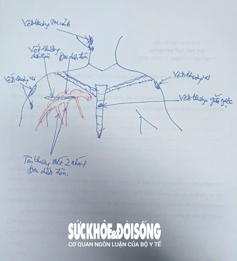 Thứ trưởng Trần Văn Thuấn: Nhân viên y tế không mang thân phận công quyền, nhưng cứu người là Thứ trưởng Trần Văn Thuấn: Nhân viên y tế không mang thân phận công quyền, nhưng cứu người là