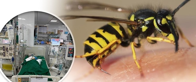 Cứu sống bé gái bị suy đa tạng do ong vò vẽ đốt - Ảnh 1. Cứu sống bé gái bị suy đa tạng do ong vò vẽ đốt - Ảnh 1.