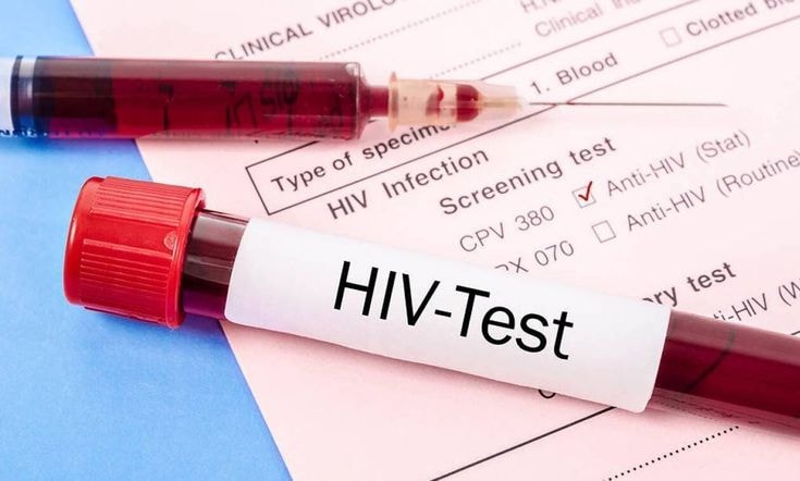 Thực trạng HIV/AIDS ở Việt Nam: Dịch đã được kiểm soát nhưng chưa thể chủ quan- Ảnh 2.