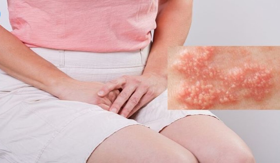 Nhiều trẻ vị thành niên mắc bệnh tình dục do quan hệ sớm- Ảnh 1.