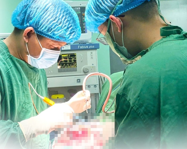 Cứu sống bé gái 6 tuổi bị chấn thương sọ não nặng sau tai nạn ngã xe- Ảnh 1.