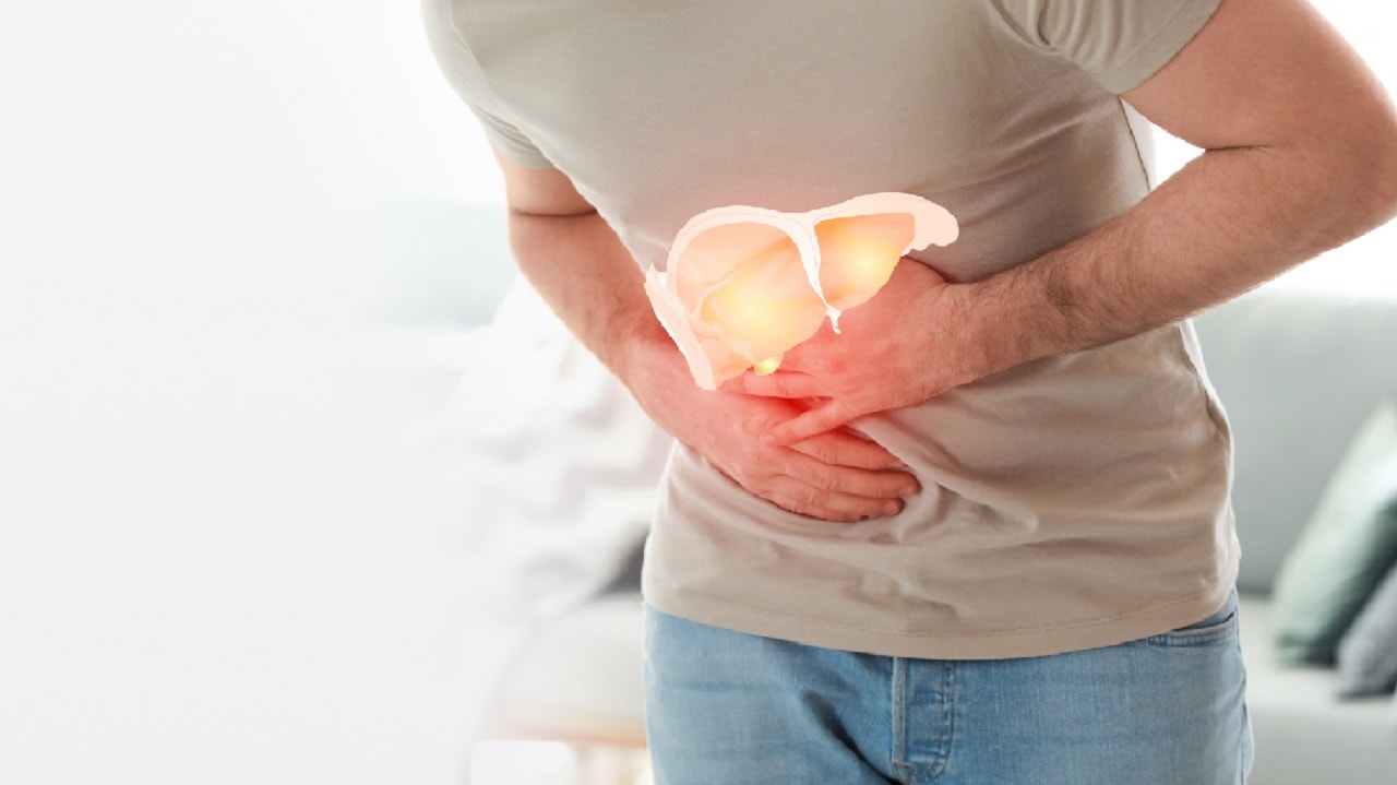 Gan nhiễm mỡ độ I có cần uống thuốc bổ gan không?- Ảnh 1.