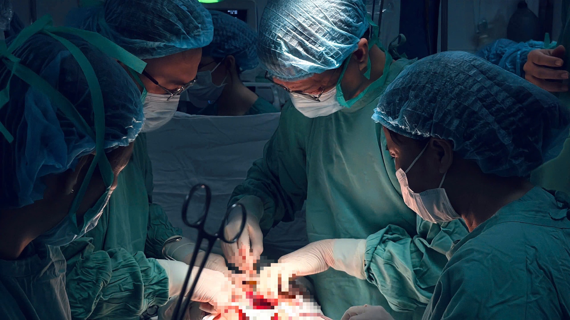 Ca phẫu thuật khẩn cấp trong mưa lũ cứu sống sản phụ ở Huế- Ảnh 1.